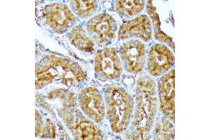 Immunohistochemistry of paraffin-embedded rat kidney using  Rabbit mAb (ABIN7265369) at dilution of 1:100 (40x lens).