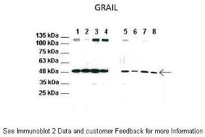 Lanes:   1: CD4 T cell lysate from WT mice, 2: CD4 T cell lysate from WT mice treated with anti-CD3/CD28, 3: CD4 T cell lysate from WT mice treated with FK506, 4: CD4 T cell lysate from WT mice treated with anti-CD3/CD28 and FK506, 5: CD4 T cell lysate from TRPV1 KO mice, 6: CD4 T cell lysate from TRPV1 KO mice treated with anti-CD3/CD28, 7: CD4 T cell lysate from TRPV1 KO mice treated with FK506, 8: CD4 T cell lysate from TRPV1 KO mice treated with anti-CD3/CD28 and FK506.