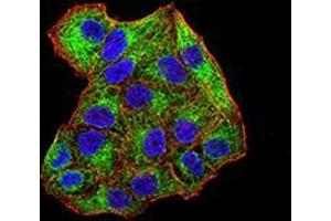 Immunofluorescence analysis of Hela cells using SYK mouse mAb (green).