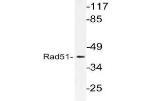 Western blot (WB) analysis of Rad51 antibody in extracts from LOVO cells. (RAD51 anticorps)