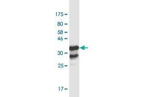 Western Blot detection against Immunogen (37. (ZBTB7B anticorps  (AA 433-537))