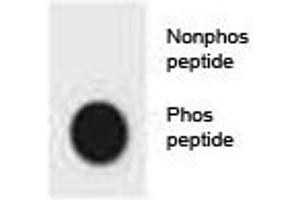 Dot blot analysis of phospho-CDKN2A antibody.