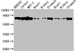 Western Blot Positive WB detected in: HEK293 whole cell lysate, Jurkat whole cell lysate, MCF-7 whole cell lysate, Rat heart tissue, Rat kideny tissue, Rat stomach tissue, Mouse heart tissue, Mouse kidney tissue, Mouse stomach tissue All lanes: PRKCH antibody at 3. (PKC eta anticorps  (AA 1-678))