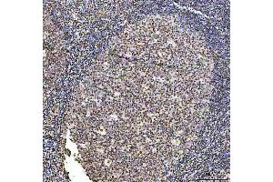 IHC analysis of Exonuclease 1/EXO1 using anti-Exonuclease 1/EXO1 antibody (ABIN7599229).