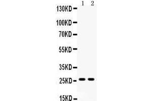 Anti-DUT antibody,  Western blotting All lanes: Anti DUT () at 0.