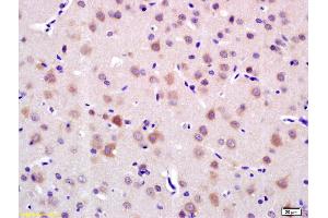 Formalin-fixed and paraffin embedded rat brain labeled with Anti-LRIG1 Polyclonal Antibody, Unconjugated (ABIN735263) at 1:200 followed by conjugation to the secondary antibody and DAB staining. (Lrig1 anticorps  (AA 1001-1093))