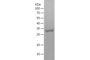 Western Blotting (WB) image for Sulfotransferase Family, Cytosolic, 2A, Dehydroepiandrosterone (DHEA)-Preferring, Member 1 (SULT2A1) (AA 200-285) protein (His-IF2DI Tag) (ABIN7125238)