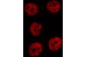 ABIN6274751 staining Hela cells by IF/ICC.