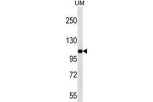 Western blot analysis in UM cell line lysates (35ug/lane) using Myosin-IIIb Antibody (C-term). (MYO3B anticorps  (C-Term))