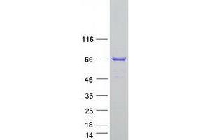 Validation with Western Blot