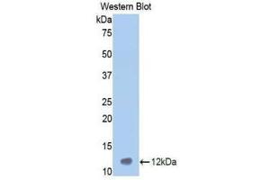 Western Blotting (WB) image for anti-Vitronectin (VTN) (AA 400-468) antibody (ABIN1860949) (Vitronectin anticorps  (AA 400-468))