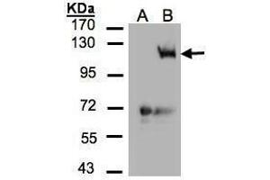 WB Image Western Blot analysis of PIK3CG expression in transfected 293T cell line by PIK3CG polyclonal antibody. (PIK3 gamma anticorps  (C-Term))