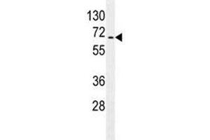 S6K2 antibody western blot analysis in Jurkat lysate