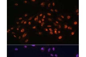 Immunofluorescence analysis of C6 cells using EFTUD2 Polyclonal Antibody at dilution of 1:100.