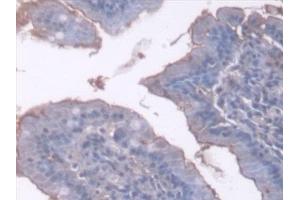 Detection of AT in Rat Small intestine Tissue using Polyclonal Antibody to Antithrombin (AT)