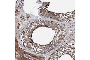 Immunohistochemical staining of human testis with FGD4 polyclonal antibody  shows distinct cytoplasmic positivity in cells in seminiferus ducts. (FGD4 anticorps)