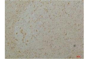 Immunohistochemical analysis of paraffin-embedded Mouse Brain Tissue using Cav1. (CACNA1D anticorps)