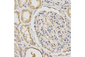 Immunohistochemistry (IHC) image for anti-Propionyl CoA Carboxylase beta Polypeptide (PCCB) antibody (ABIN1876603)