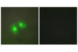 Immunofluorescence analysis of A549 cells, using TOP2A antibody.