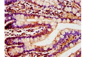 IHC image of ABIN7172046 diluted at 1:400 and staining in paraffin-embedded human small intestine tissue performed on a Leica BondTM system.