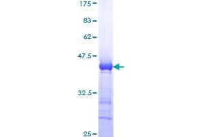 Image no. 1 for Structural Maintenance of Chromosomes 1A (SMC1A) (AA 366-465) protein (GST tag) (ABIN1320652)