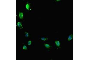 Immunofluorescent analysis of Hela cells using ABIN7172767 at dilution of 1:100 and Alexa Fluor 488-congugated AffiniPure Goat Anti-Rabbit IgG(H+L) (ATRX anticorps  (AA 2161-2443))