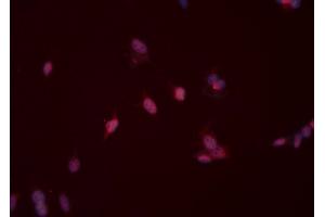 ABIN6276526 staining HeLa cells by ICC/IF. (MSH2 anticorps  (C-Term))