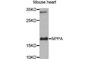 Western blot analysis of extracts of mouse heart, using NPPA antibody (ABIN5970781) at 1/1000 dilution.