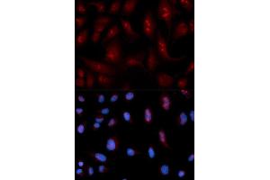 Immunofluorescence analysis of U2OS cell using PLCB1 antibody. (Phospholipase C beta 1 anticorps  (AA 917-1216))