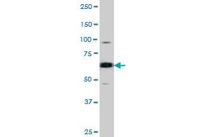 The CDC25B (phospho S187) polyclonal antibody  is used in Western blot to detect Phospho-CDC25B-S187 in SK-BR-3 cell lysate