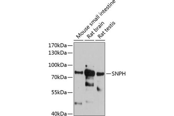 Syntaphilin 抗体  (AA 300-425)