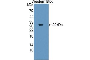 Detection of Recombinant PSMb6, Human using Polyclonal Antibody to Proteasome Subunit Beta Type 6 (PSMb6)