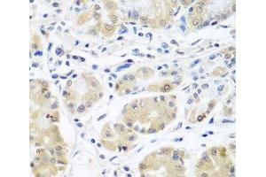 Immunohistochemistry of paraffin-embedded Human stomach using EIF3A Polyclonal Antibody at dilution of 1:100 (40x lens). (EIF3A anticorps)