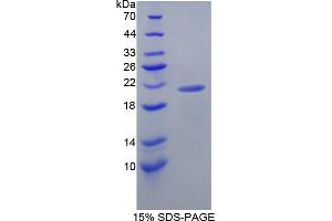 Image no. 1 for Lipocalin 8 (LCN8) (AA 27-176) protein (His tag) (ABIN4990175)