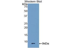 Western blot analysis of the recombinant protein. (CCL22 anticorps  (AA 29-92))
