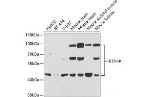 Western blot analysis of extracts of various cell lines using RTN4R Polyclonal Antibody at dilution of 1:1000. (RTN4R anticorps)