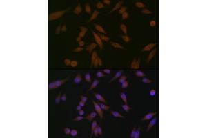 Immunofluorescence analysis of HeLa cells using P Rabbit mAb (ABIN1682842, ABIN3019312, ABIN3019313 and ABIN7101749) at dilution of 1:100 (40x lens).