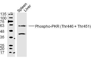 Mouse spleen and liver lysates probed with PKR(Thr446+Thr451) Polyclonal Antibody, unconjugated  at 1:300 overnight at 4°C followed by a conjugated secondary antibody at 1:10000 for 90 minutes at 37°C. (EIF2AK2 anticorps  (pThr446, pThr451))