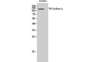 Western Blot (WB) analysis of Jurkat cells using VE-Cadherin Polyclonal Antibody.