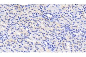 Detection of MSRA in Human Kidney Tissue using Polyclonal Antibody to Methionine Sulfoxide Reductase A (MSRA) (MSRA anticorps  (AA 27-235))