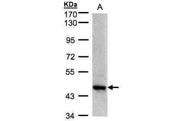 ZBTB24 anticorps  (C-Term)