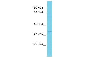 Host: Rabbit Target Name: OR7A5 Sample Type: Jurkat Whole Cell lysates Antibody Dilution: 1. (OR7A5 anticorps  (C-Term))