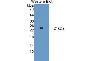 Detection of Recombinant TAK1L, Mouse using Polyclonal Antibody to TAK1 Like Protein (TAK1L) (MAP3K7CL anticorps  (AA 1-142))