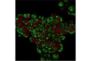 Immunofluorescent staining of PFA-fixed MCF-7 cells.