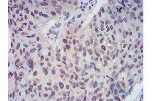 Immunohistochemistry (IHC) image for anti-Chromobox Homolog 3 (CBX3) (AA 1-183) antibody (ABIN5889677) (CBX3 anticorps  (AA 1-183))