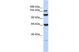 WB Suggested Anti-C17orf57 Antibody Titration: 0. (C17orf57 anticorps  (N-Term))