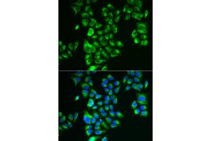 Immunofluorescence analysis of A549 cells using GLUD2 antibody (ABIN5973969). (GLUD2 anticorps)