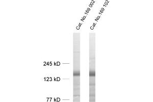 dilution: 1 : 1000, sample: rat brain homogenate (LIPA3 anticorps  (AA 313-461))
