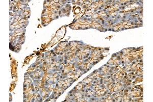 Phospho-eIF4B (Ser504) Antibody at 1/100 staining Rat muscle tissue by IHC-P. (EIF4B anticorps  (pSer504))