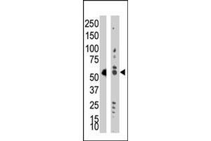 Western blot analysis of TRDMT1 polyclonal antibody  in Jurkat cell lysate (Lane A) and mouse liver tissue lysate (Lane B) . (Dnmt2 anticorps  (AA 353-383))